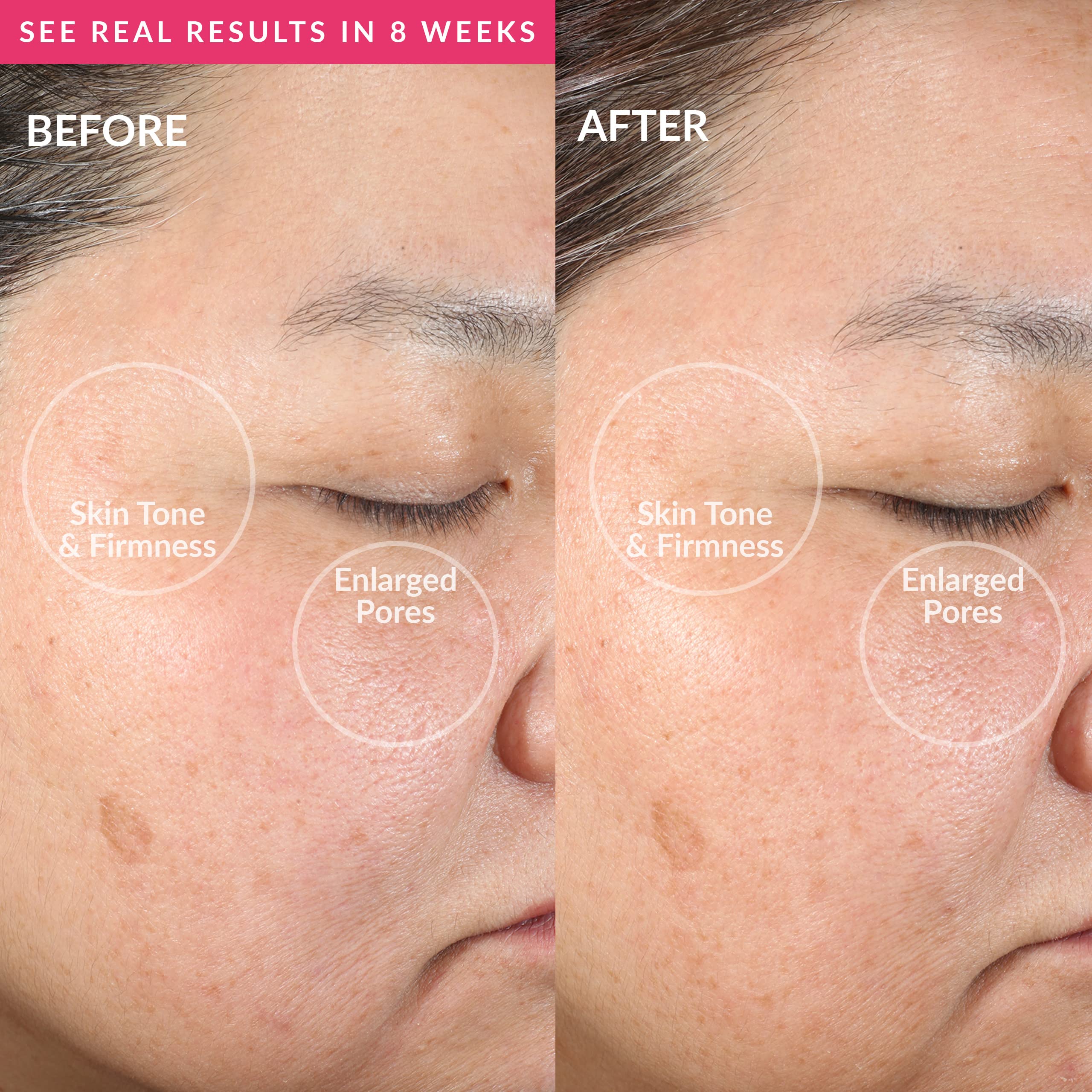 PMD Clean - Smart Facial Cleansing Device with Silicone Brush & Anti-Aging Massager - Waterproof - SonicGlow Vibration Technology - Lift, Firm, and Tone Skin on Face and Body - Pink